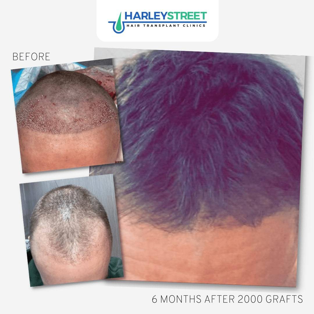 Before & After Results Before & After Results