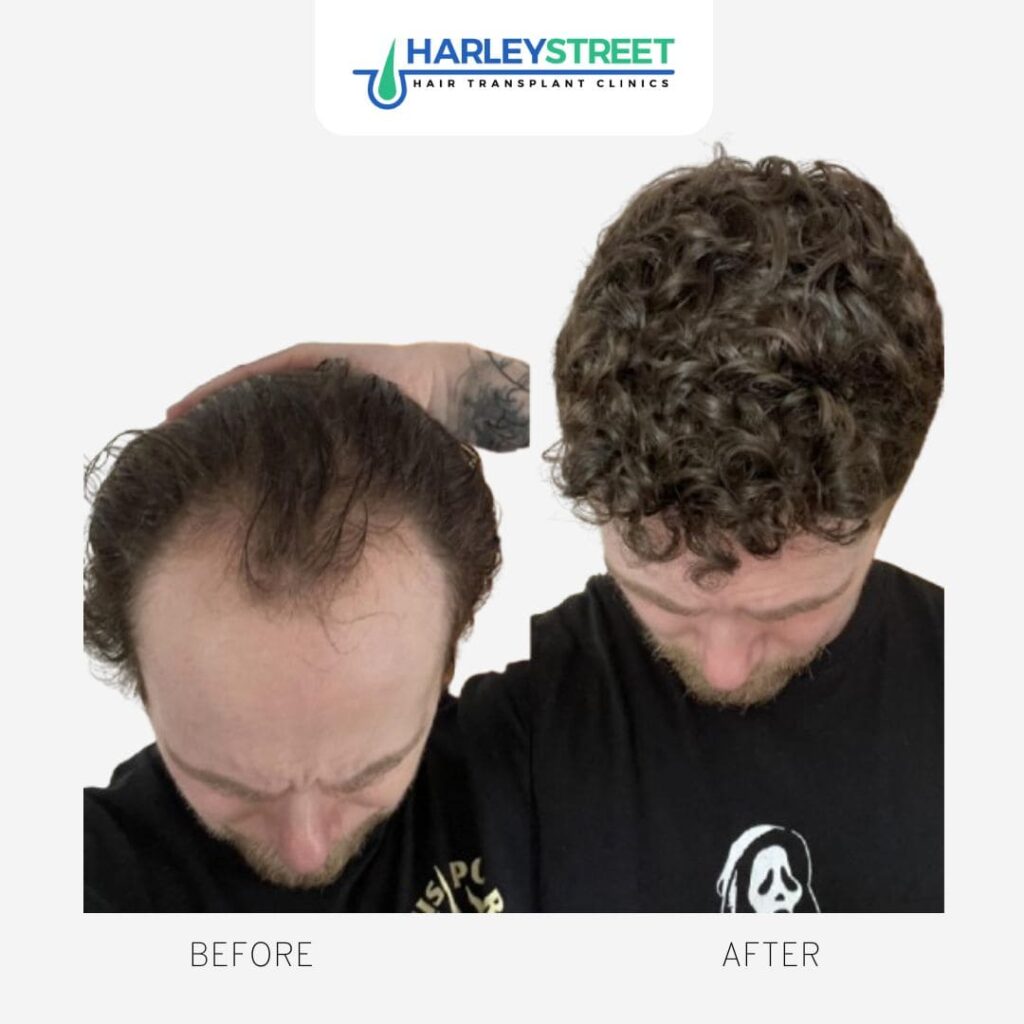 Home Harley Street HT Pt before and after
